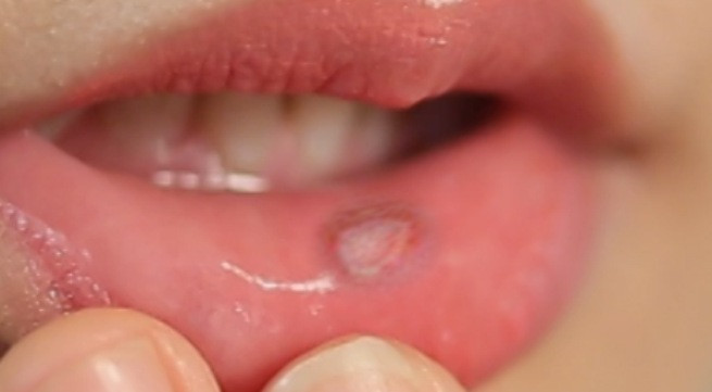 Ảnh minh họa: Internet