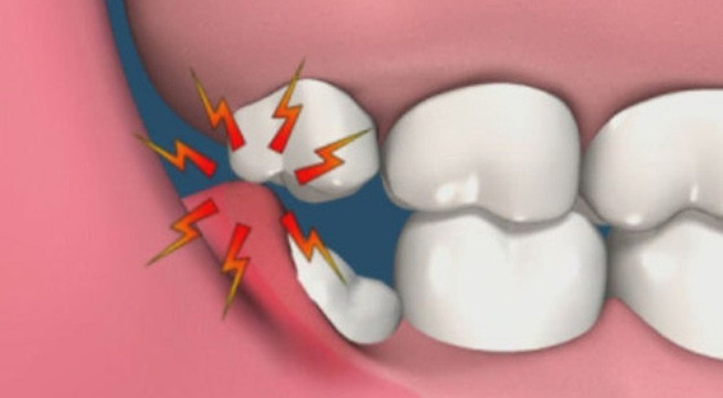 Ảnh minh họa: Internet
