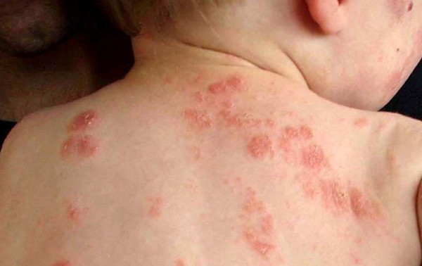 Ảnh minh họa: Internet