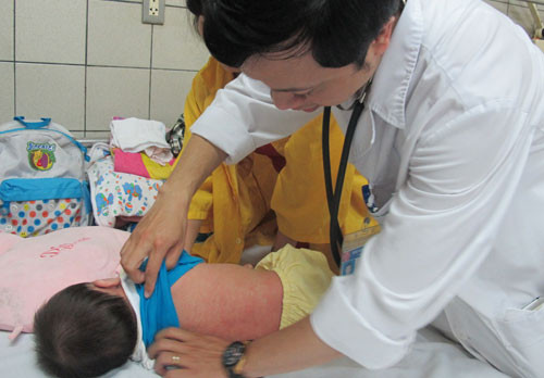 BS khám cho bệnh nhi mắc sởi. Ảnh: Internet