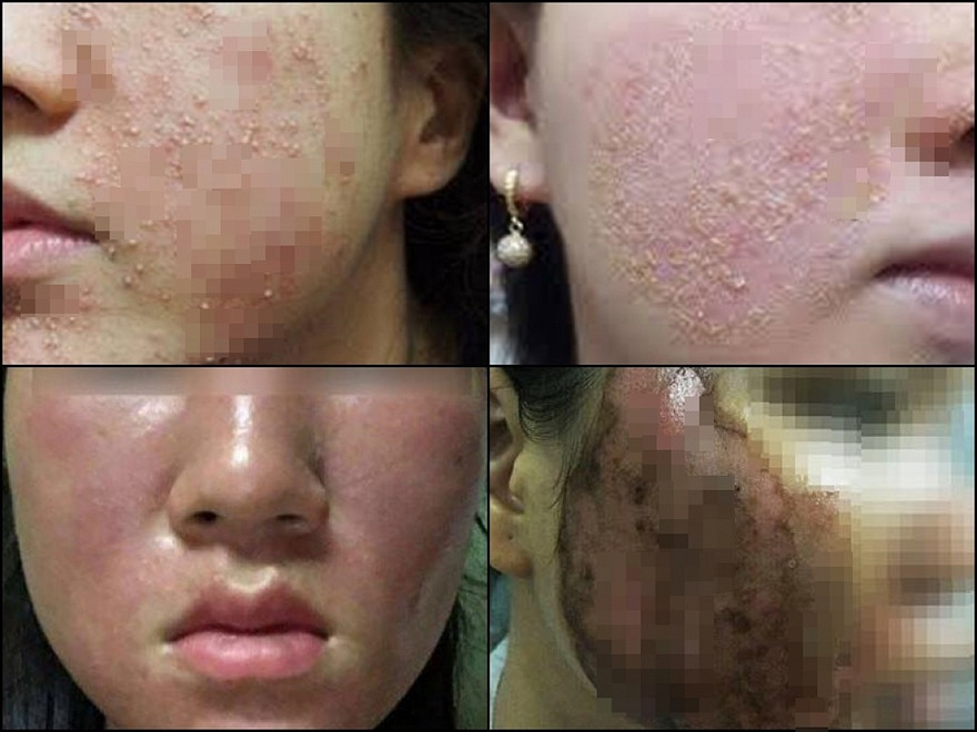 Ảnh minh họa: Internet