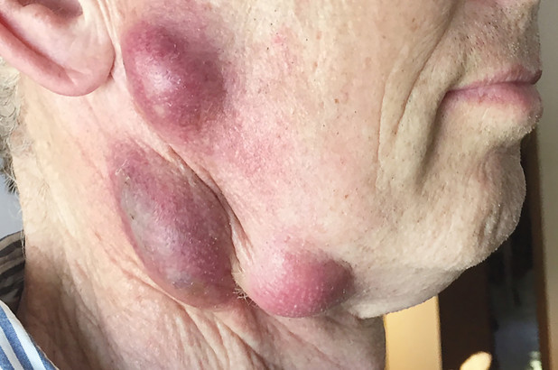 Cổ của người chủ nuôi mèo bị sưng phồng khi chú mèo yêu của ông bị chết vì bệnh bạch cầu.