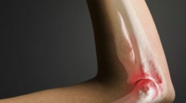 Ảnh minh họa: Internet