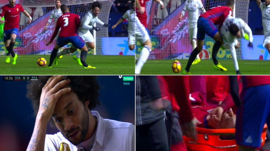 Tano Bonnin gãy chân kinh hoàng sau pha va chạm với Isco.