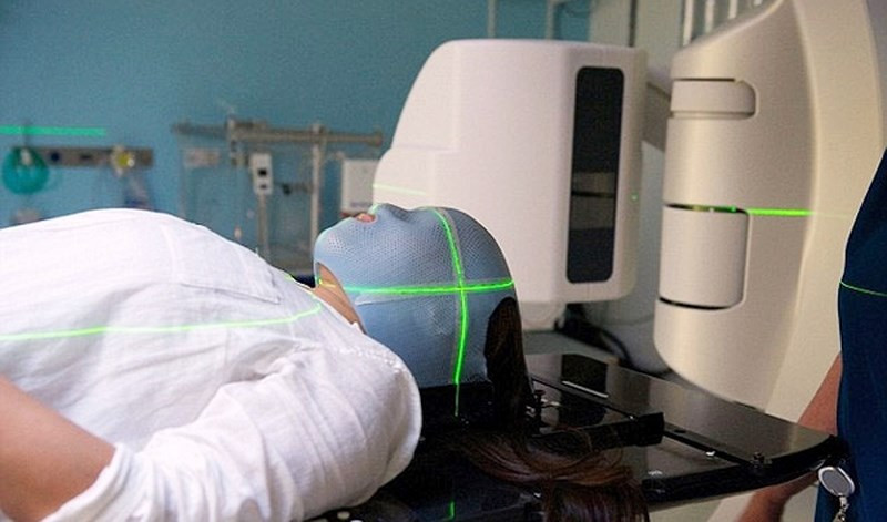 Xạ trị cho bệnh nhân ung thư. Ảnh minh hoạ: Internet