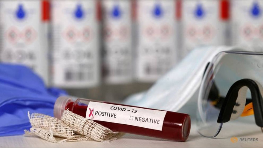 Phương pháp xét nghiệm của các nhà nghiên cứu Australia được cho là đột phá khóa học.