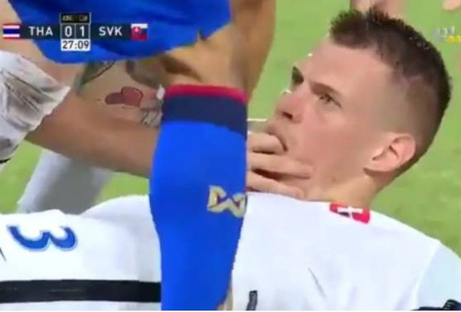 Martin Skrtel chút nữa đã cắn lưỡi trong vô thức.