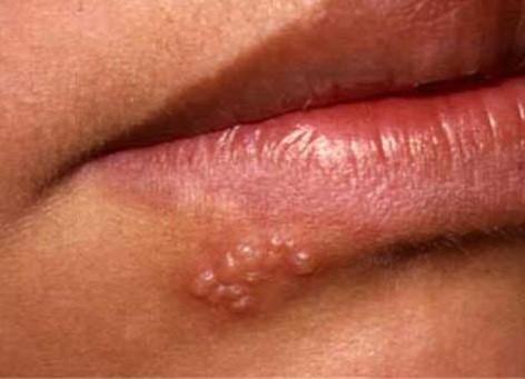 Ảnh minh hoạ: Internet