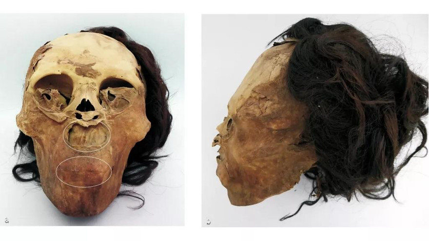 Nghiên cứu xác ướp người phụ nữ 1.000 năm trước tiết lộ nạn bạo hành nông dân.