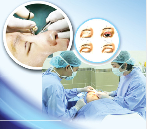 Ảnh minh hoạ: Internet