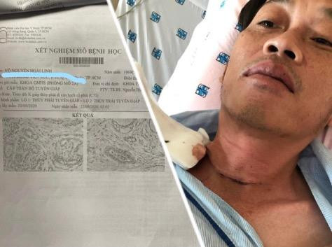 Hoài Linh hai lần xạ trị, phải uống hormon hằng ngày