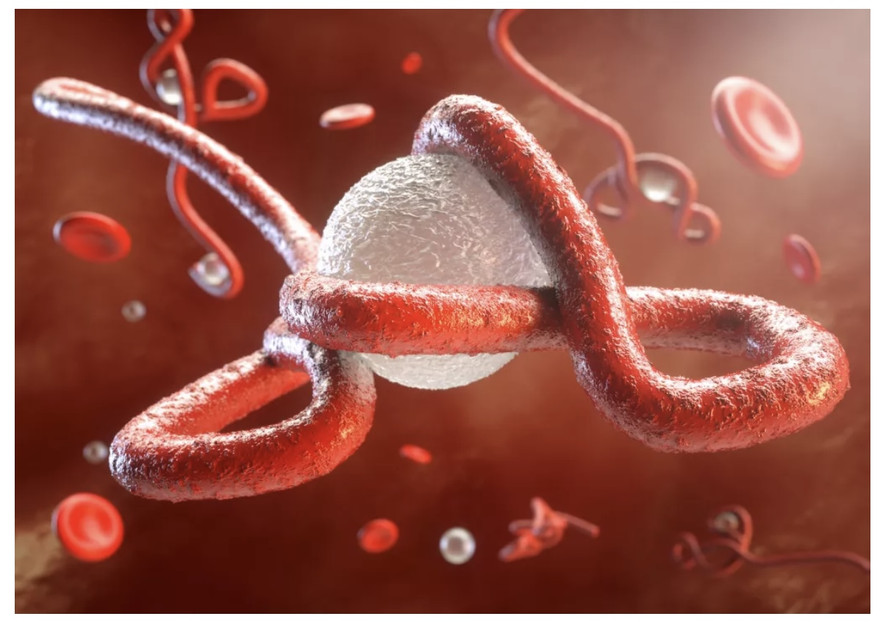 Virus Ebola lại bùng phát trở lại tại châu Phi,