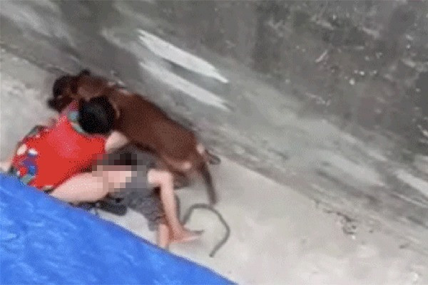 Bà D. bị con chó becgie xông vào cắn gây đa chấn thương