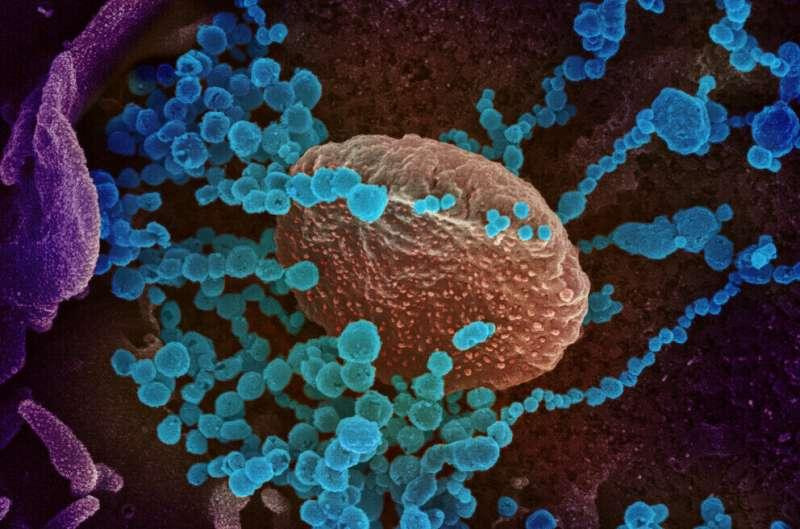 Virus SARS-CoV-2 ( màu xanh) được chụp qua kính hiển vi điện tử.