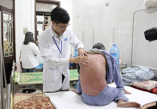Các BS khẳng định, không thể chữa khỏi hẳn bệnh vẩy nến như quảng cáo tràn lan trên mạng. Ảnh: BS khám cho bệnh nhân bị vảy nến tại BV Da liễu TƯ