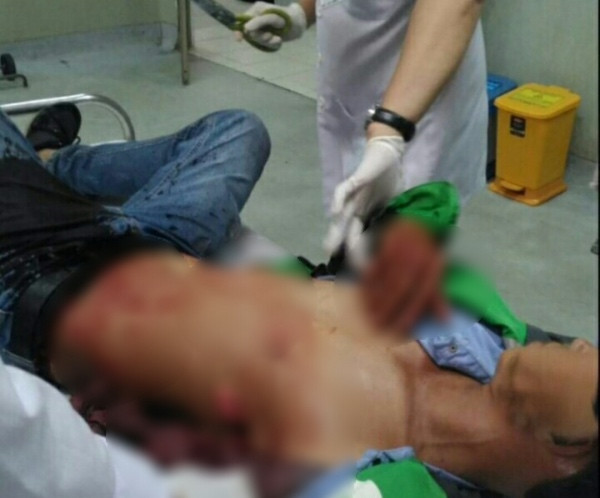 Nhân viên quán nhậu đâm khách vì chê tiền bo ít