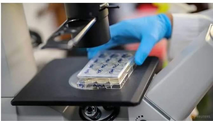 Các tế bào sản sinh kháng thể chống lại COVID-19 được đưa vào soi qua kính hiển vi.