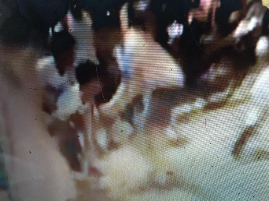 Nam thanh niên 17 tuổi (giữa) bị đâm vào bụng. Ảnh: TN