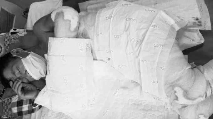 Ông Thiện đang tích cực cấp cứu tại bệnh viện đa khoa Lạng Sơn nhưng tiên lượng xấu, nguy cơ đến tử vong. Ảnh: ĐK