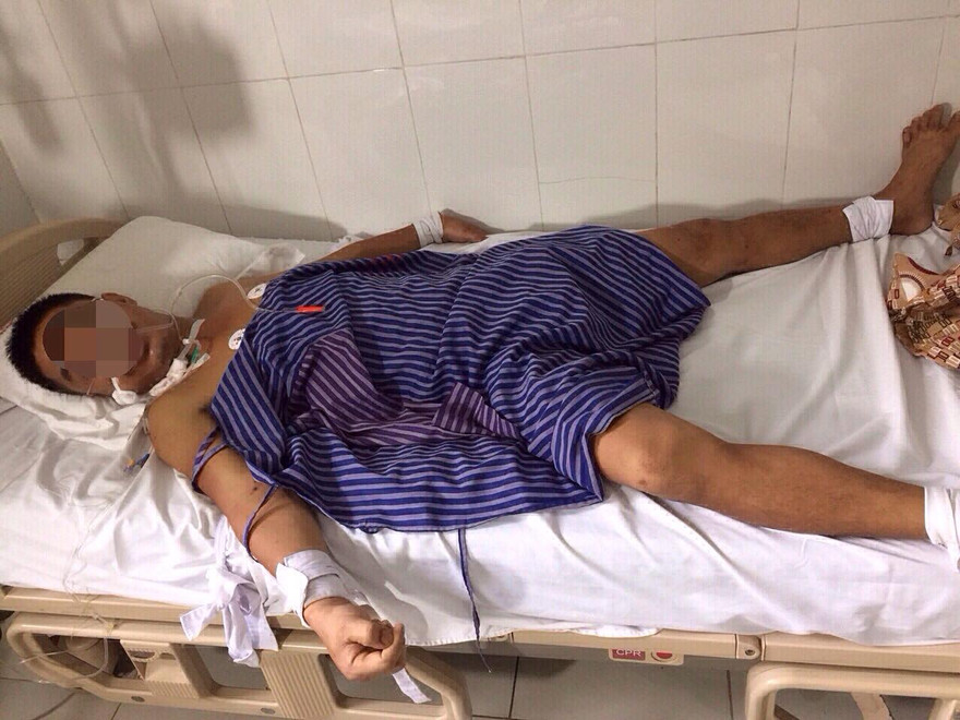 Bệnh nhân Tít cấp cứu tại bệnh viện do bị ong tấn công *ảnh: ĐK