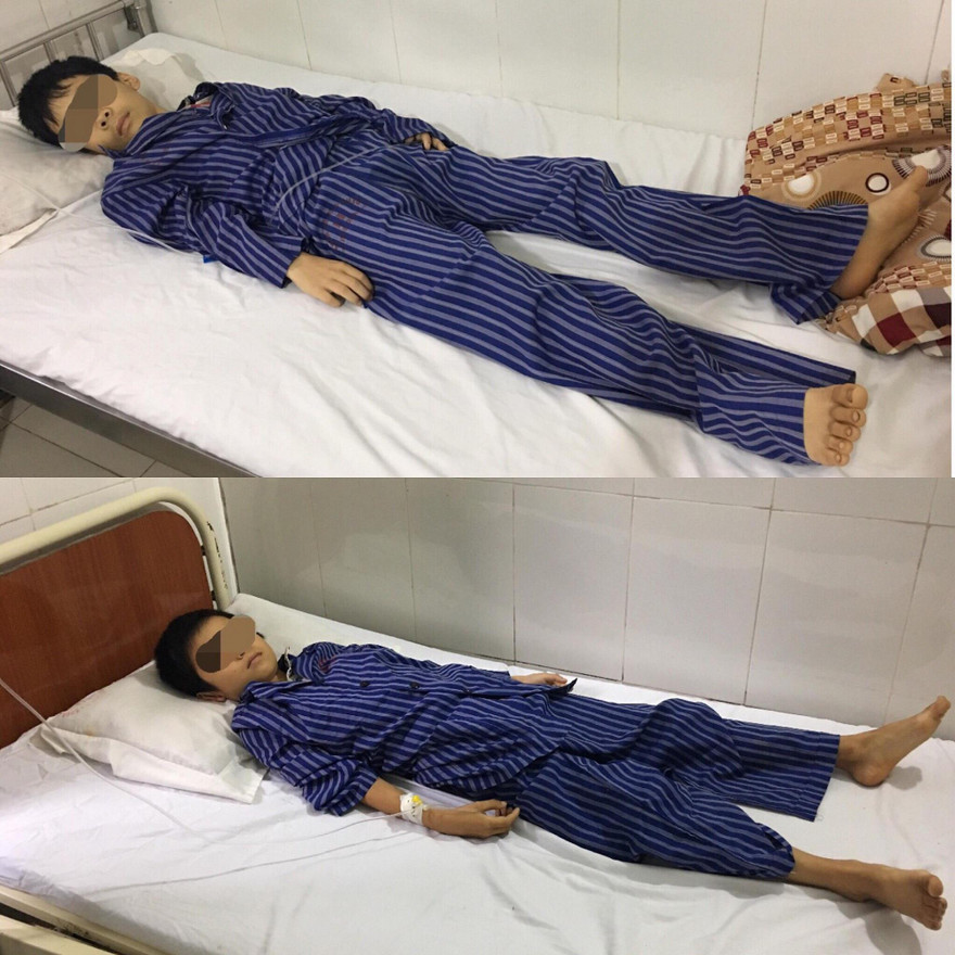 Hai anh em bị ngộ độc đang cấp cứu tại bệnh viện .Ảnh: Đ.K