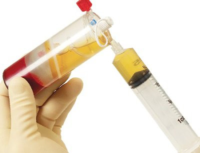 Huyết tương có thể tạo ra kháng thể tiêu diệt virus SARS-CoV-2