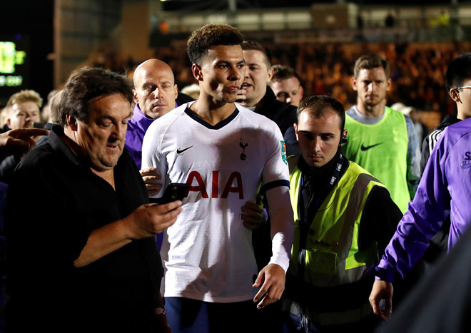 Tottenham thua sốc trước Colchester United.