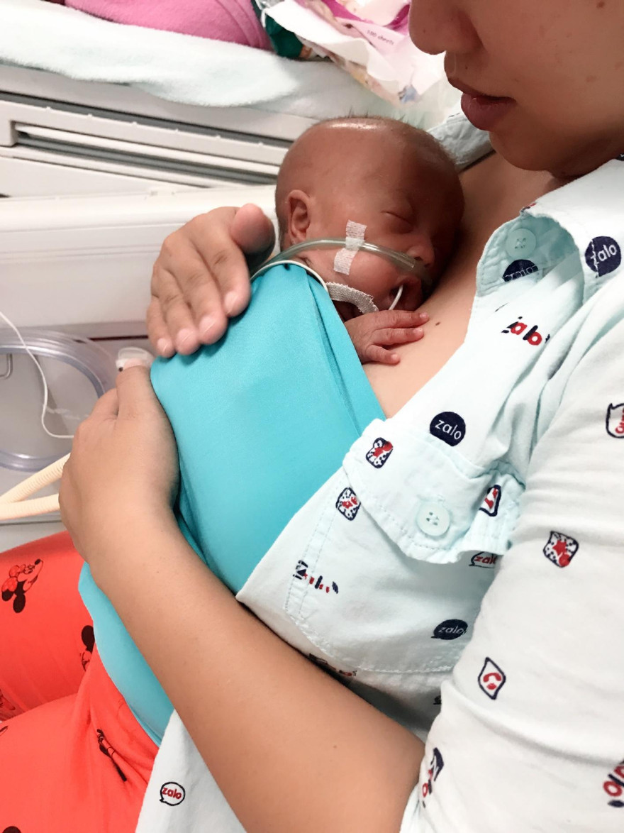 Bé trai 24 tuần nặng 600gr được cứu sống thần kỳ