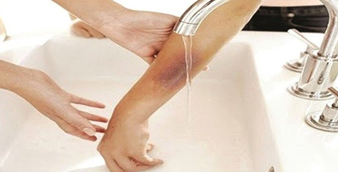 Ảnh minh hoạ: Internet