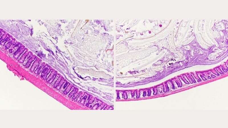 Hình ảnh phóng đại ruột trước và sau ( ảnh trái và phải) sau khi ăn khẩu phần nhiều đường 7 ngày.