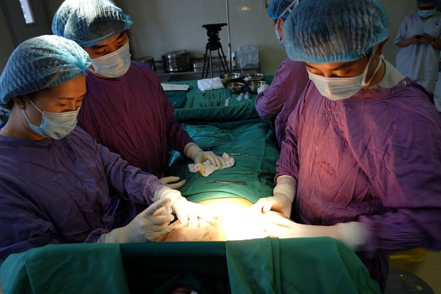 Các BS đang phẫu thuật cho bệnh nhân có vòng 1 khủng lồ