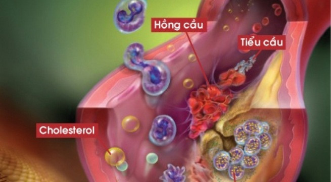 Ảnh minh họa: Internet