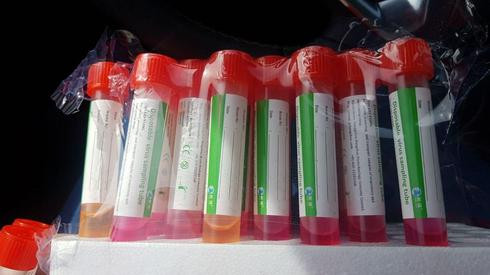 Tăm bông đổi màu tại phòng thí nghiệm khiến Israel tạm dừng xét gnhiệm COVID-19 toàn quốc.