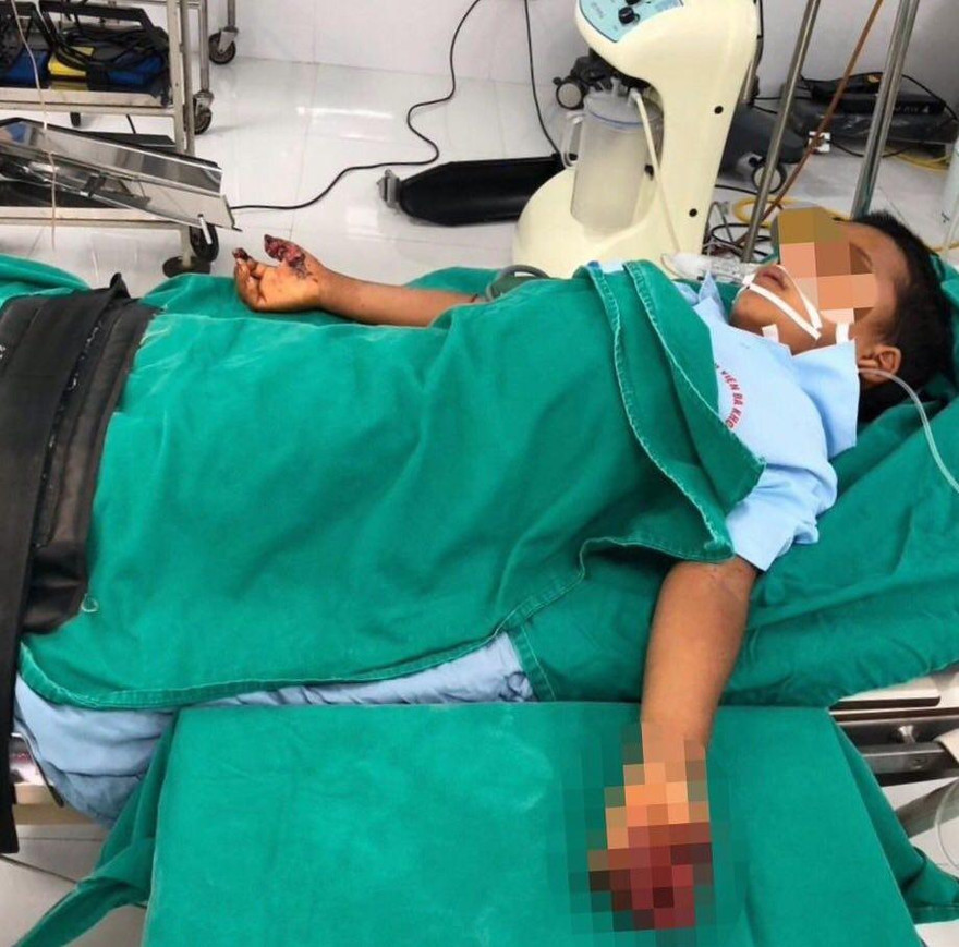 Bé C đang được điều trị tại bệnh viện đa khoa Cao Bằng -Ảnh: TL