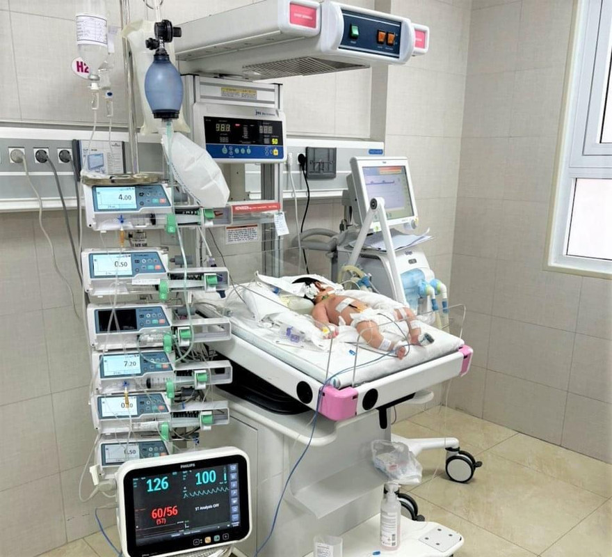 Bé sơ sinh ngộ độc nặng, suy đa tạng, phải thở máy do gia đình dùng thuốc nam điều trị viêm da cho con. Ảnh: Bệnh viện cung cấp