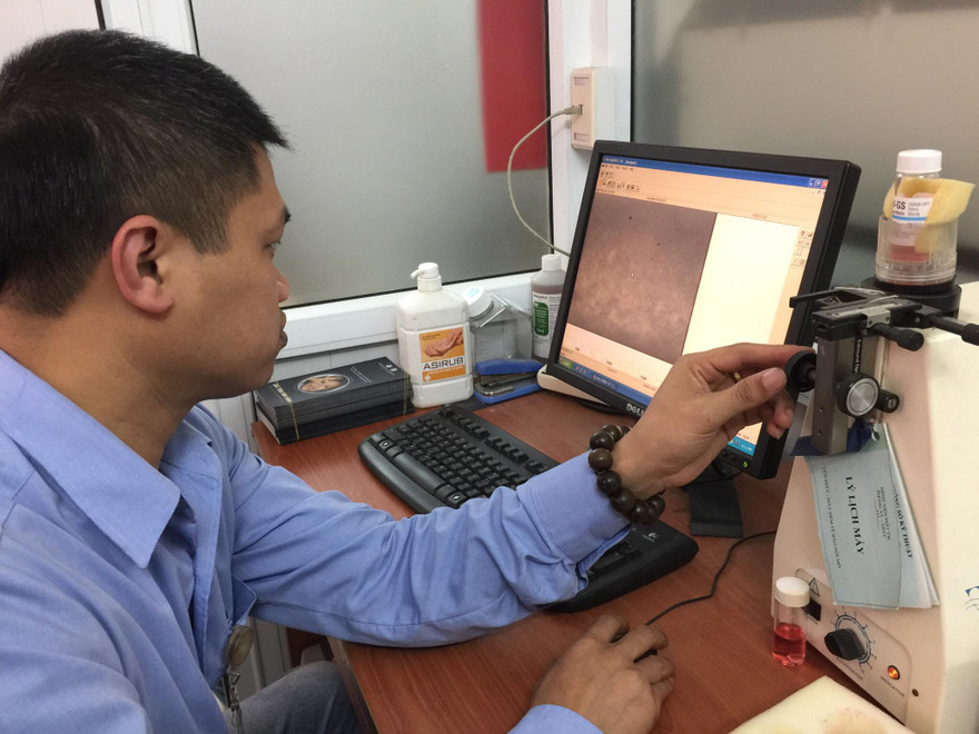 Ông Nguyễn Hữu Hoàng - GĐ Ngân hàng Mắt TƯ và chiếc lọ đựng giác mạc bé Hải An hiến tặng. Ảnh: Đức Long