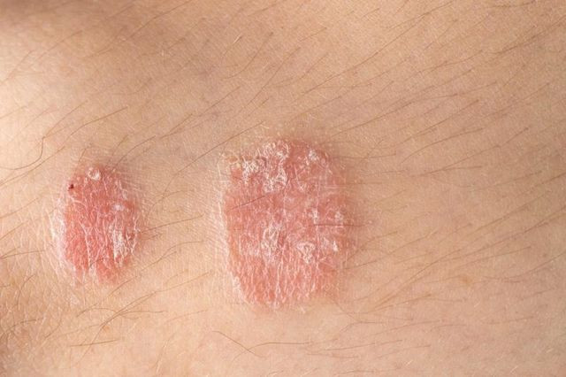 Ảnh minh hoạ: Internet