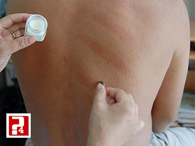 Ảnh minh họa: Internet