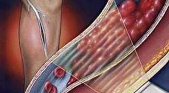 Ảnh minh họa: Internet