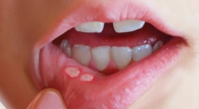 Ảnh minh hoạ: Internet