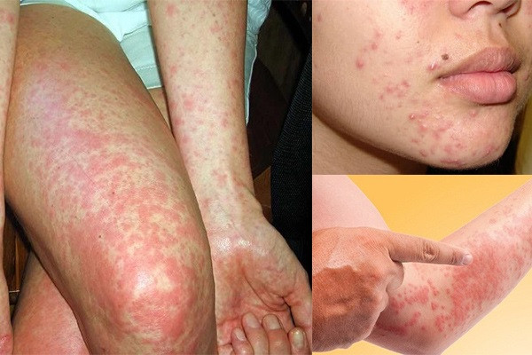 Ảnh minh hoạ: Internet