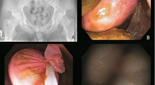 Ảnh minh họa: Internet