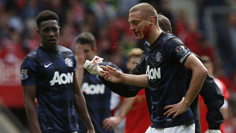 Vidic từng nhiều lần đổ máu vì M.U. 
