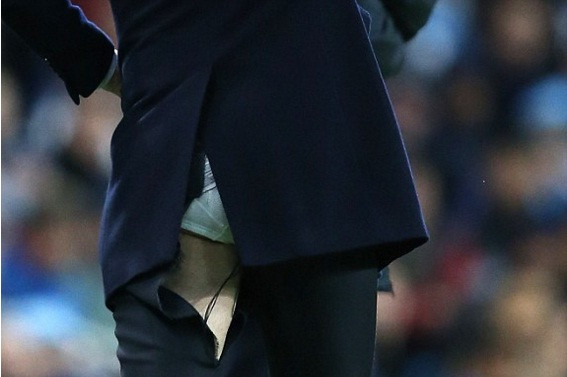 HLV Zidane lại bị rách quần.