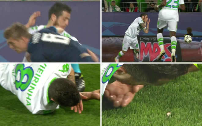 Vieirinha gãy răng sau pha thúc cùi chỏ của Kroos.