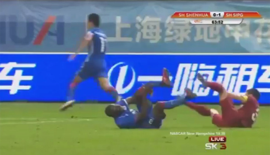 Tìn huống gãy chân kinh hoàng của Demba Ba.