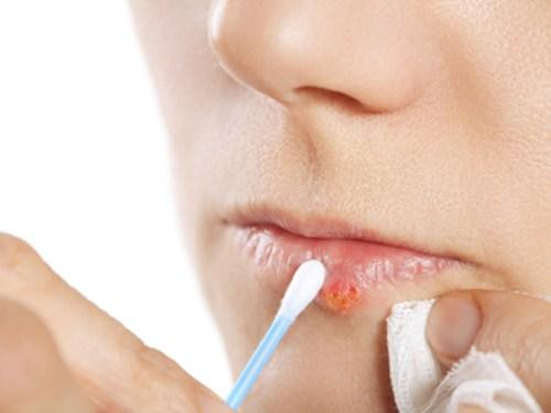 Ảnh minh hoạ: Internet