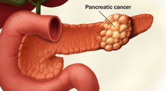 Ảnh minh họa: Internet