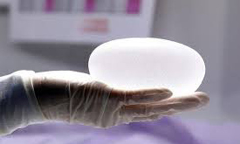 Ảnh minh hoạ: Internet