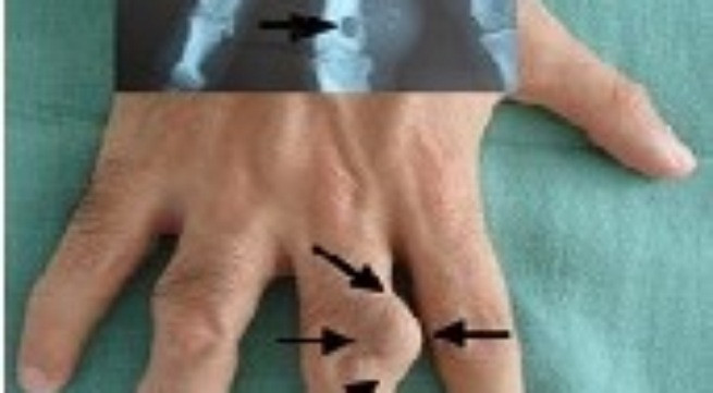 Ảnh minh họa: Internet